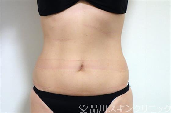 症例NO.29422のBEFORE写真
