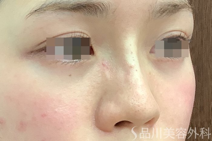 症例NO.63002のAFTER写真