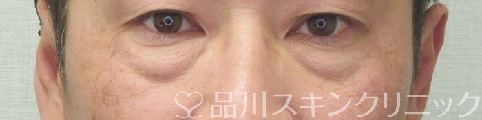 症例NO.73726のBEFORE写真