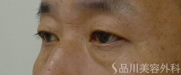 症例NO.72159のBEFORE写真