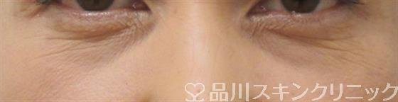 症例NO.26178のBEFORE写真