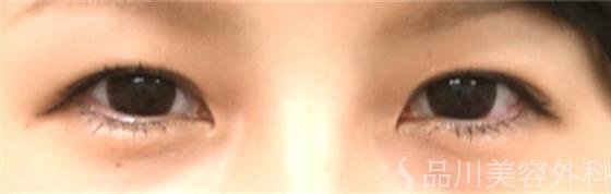 症例NO.20272のAFTER写真