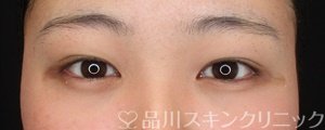 症例NO.74520のAFTER写真