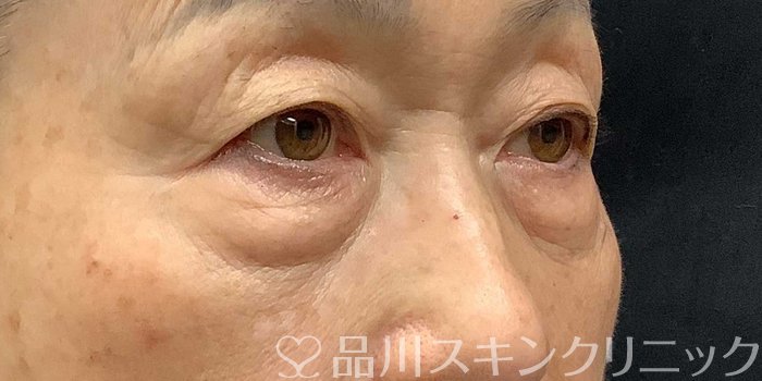 症例NO.69668のBEFORE写真