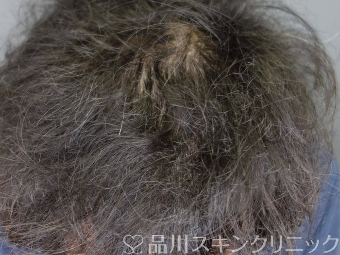 症例NO.73493のAFTER写真