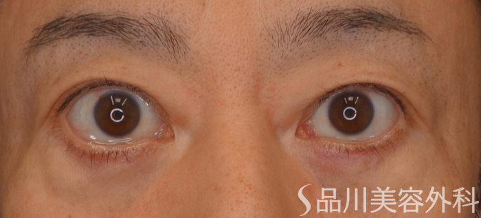 症例NO.65030のAFTER写真