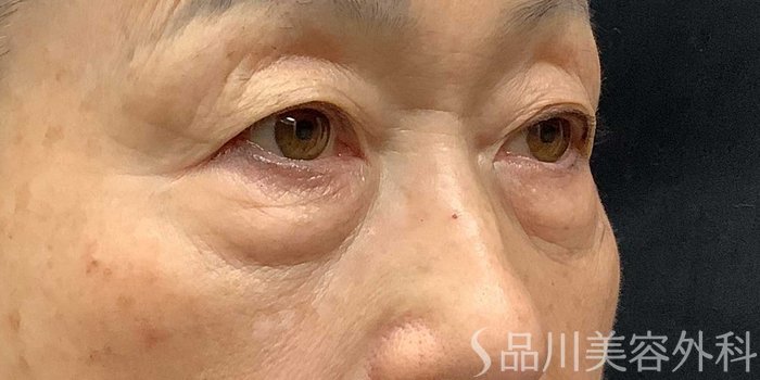 症例NO.69668のBEFORE写真