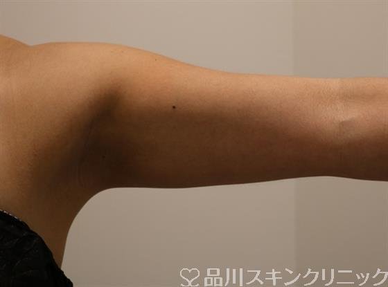 症例NO.43808のAFTER写真