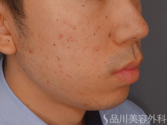 症例NO.73672のAFTER写真