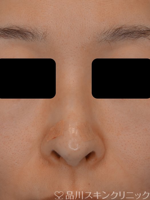 症例NO.73745のAFTER写真
