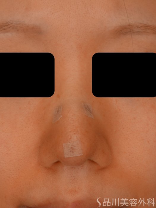 症例NO.73759のAFTER写真