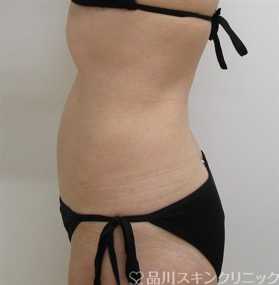 症例NO.36118のAFTER写真