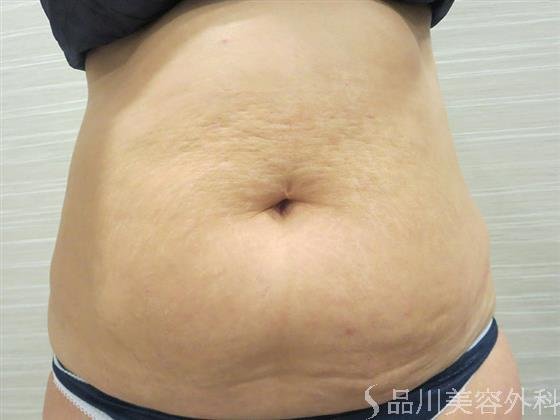 症例NO.20737のBEFORE写真