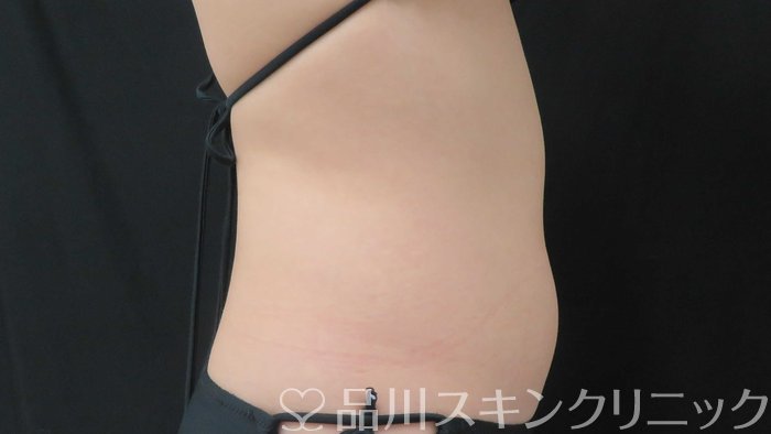 症例NO.70867のBEFORE写真