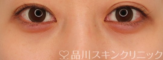 症例NO.69307のAFTER写真