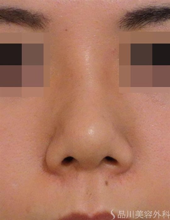 症例NO.39898のBEFORE写真