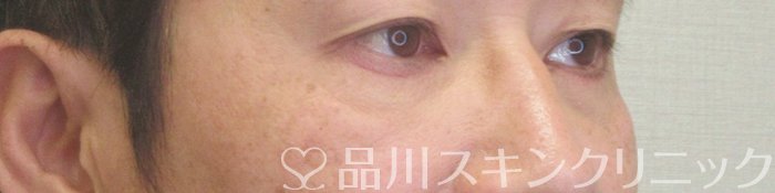 症例NO.73726のAFTER写真