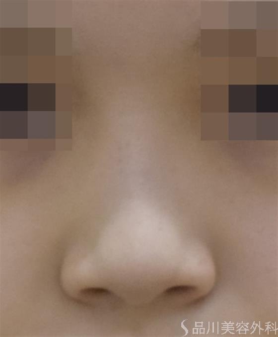 症例NO.47631のBEFORE写真