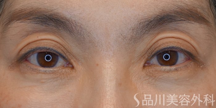 症例NO.73889のBEFORE写真