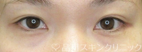 症例NO.65048のBEFORE写真