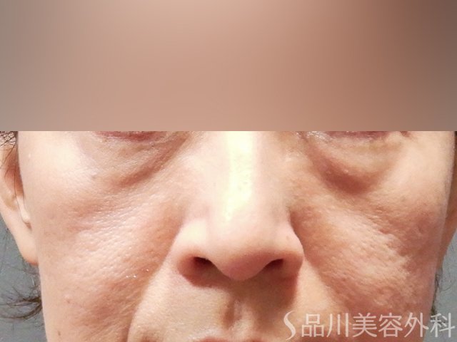 症例NO.63870のBEFORE写真