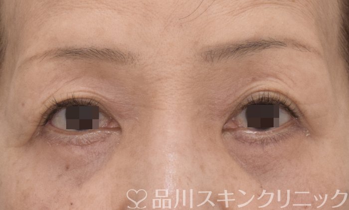 症例NO.73944のAFTER写真