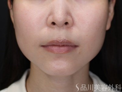 症例NO.72191のBEFORE写真