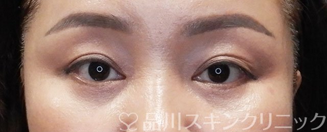 症例NO.73276のAFTER写真