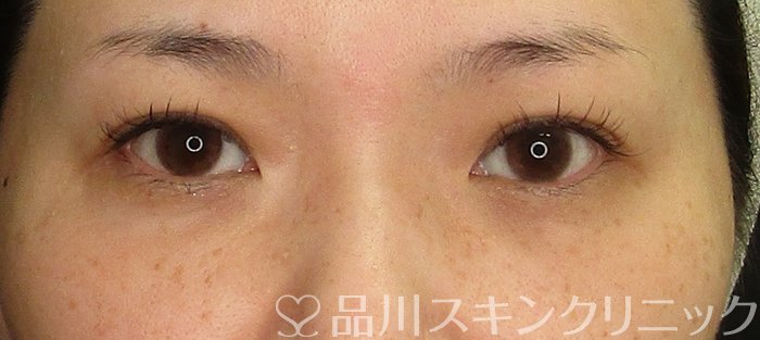 症例NO.69828のAFTER写真