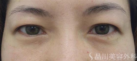 症例NO.10650のBEFORE写真