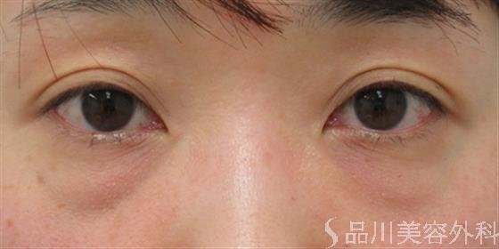 症例NO.26319のBEFORE写真