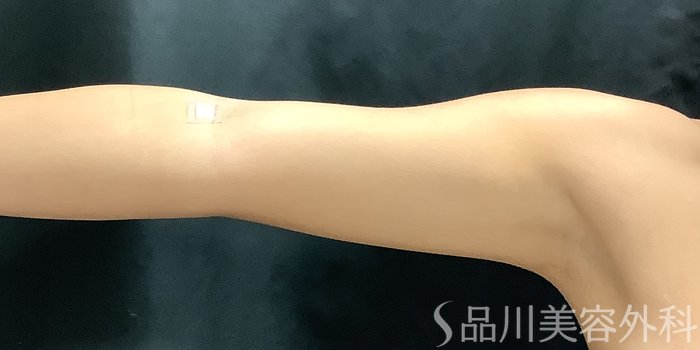 症例NO.68478のAFTER写真