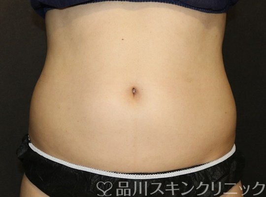 症例NO.73229のBEFORE写真