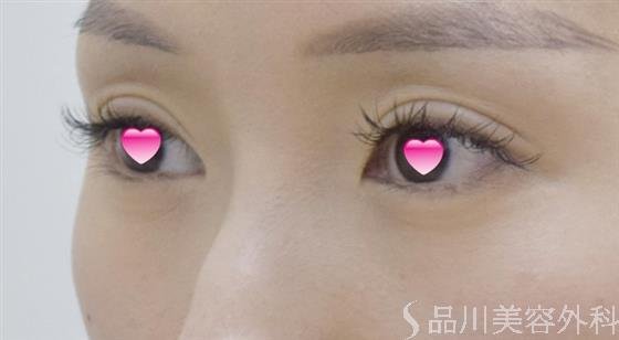 症例NO.46869のAFTER写真