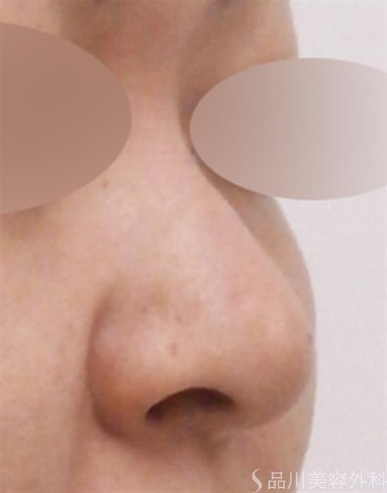 症例NO.20156のBEFORE写真