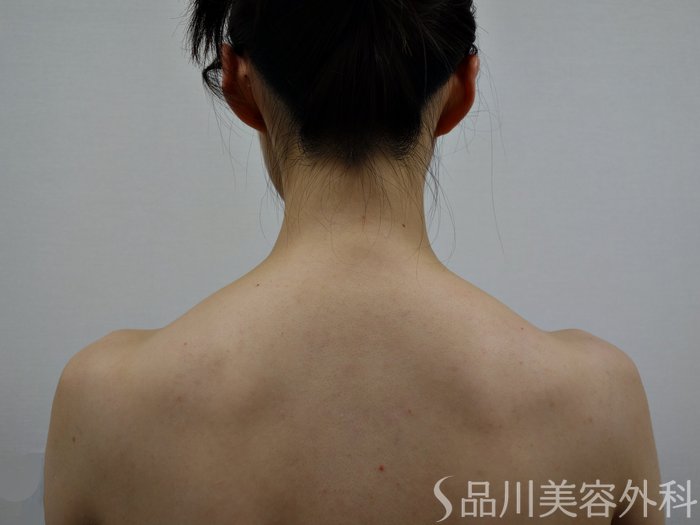 症例NO.73934のBEFORE写真