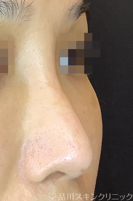 症例NO.65263のBEFORE写真