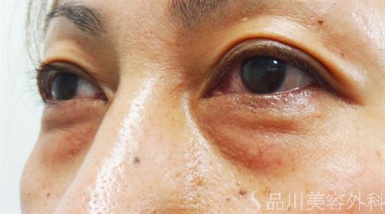 症例NO.27281のBEFORE写真