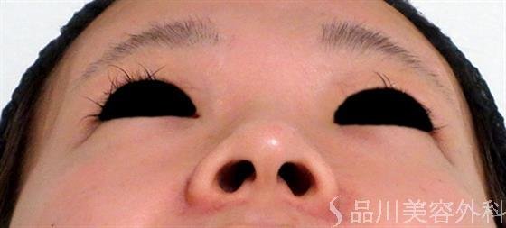 症例NO.31659のBEFORE写真