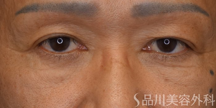 症例NO.73452のAFTER写真