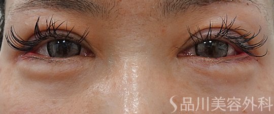 症例NO.73489のAFTER写真