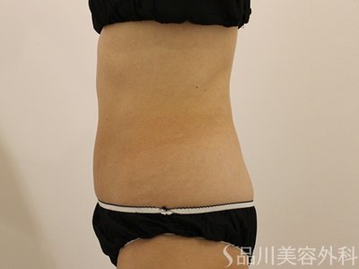 症例NO.71715のBEFORE写真