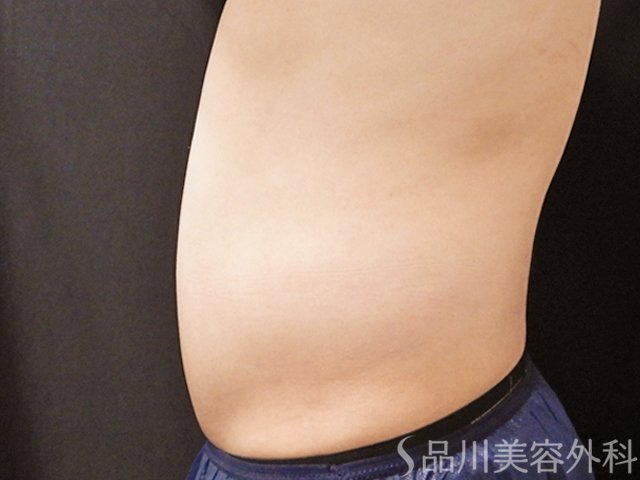 症例NO.73749のAFTER写真