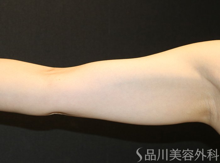 症例NO.70384のBEFORE写真