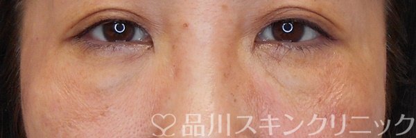 症例NO.69963のAFTER写真