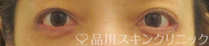症例NO.66192のAFTER写真