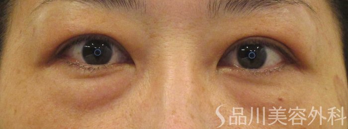 症例NO.72192のBEFORE写真