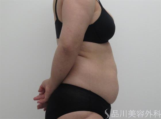症例NO.41073のBEFORE写真