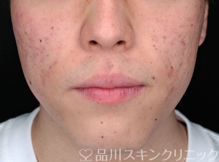 症例NO.65719のBEFORE写真
