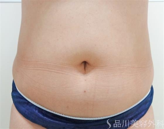 症例NO.23717のAFTER写真